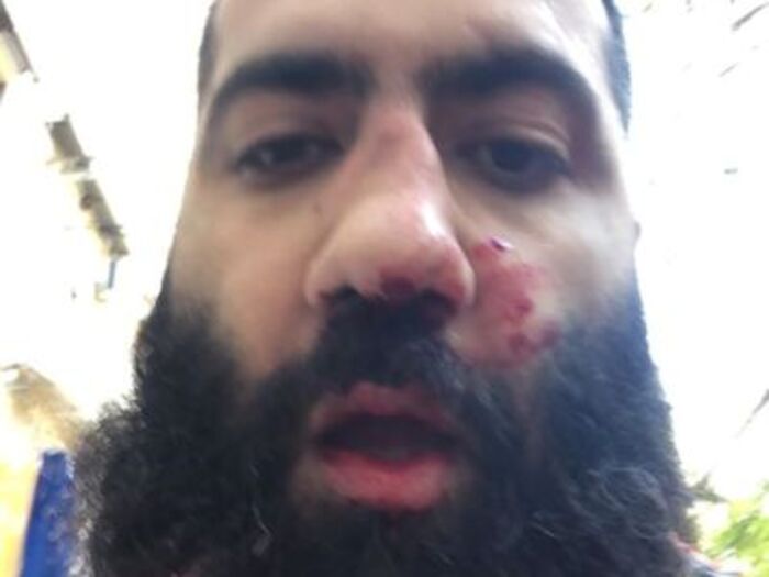 Prügelei zwischen Regierungspolitiker und Aktivist in Armenien